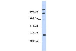 C21ORF87 antibody used at 1 ug/ml to detect target protein. (BRWD1-AS2 抗体)