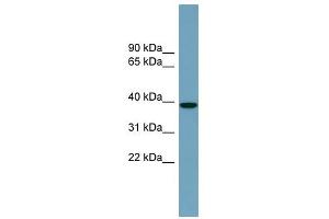 NUDCD3 antibody used at 1 ug/ml to detect target protein. (NUDCD3 抗体  (Middle Region))