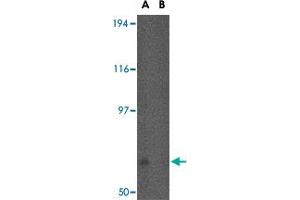 Western blot analysis of FNBP1L in human brain tissue lysate in (A) the absence and (B) the presence of blocking peptide with FNBP1L polyclonal antibody  at 0. (FNBP1L 抗体  (N-Term))