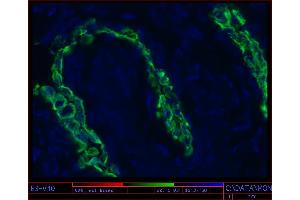 Image no. 1 for anti-Keratin 17 (KRT17) antibody (ABIN335340) (KRT17 抗体)