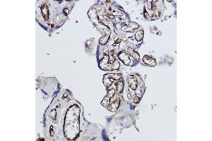 Immunohistochemistry of paraffin-embedded human placenta using Tryptophanyl-tRNA synthetase 1 Rabbit mAb (ABIN1678761, ABIN3018963, ABIN3018964 and ABIN7101695) at dilution of 1:100 (40x lens). (WARS 抗体)
