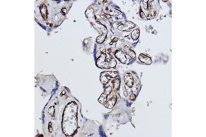 Immunohistochemistry of paraffin-embedded human placenta using Tryptophanyl-tRNA synthetase 1 Rabbit mAb (ABIN1678761, ABIN3018963, ABIN3018964 and ABIN7101695) at dilution of 1:100 (40x lens). (WARS 抗体)