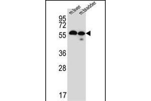 Western blot analysis of TMEM87B Antibody (C-term) (ABIN651478 and ABIN2840259) in mouse liver,bladder tissue lysates (35 μg/lane). (TMEM87B 抗体  (C-Term))