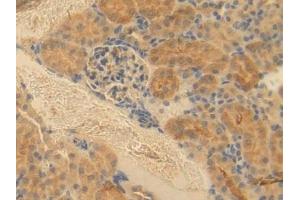 Detection of ESAM in Mouse Kidney Tissue using Polyclonal Antibody to Endothelial Cell Adhesion Molecule (ESAM) (ESAM 抗体  (AA 29-248))