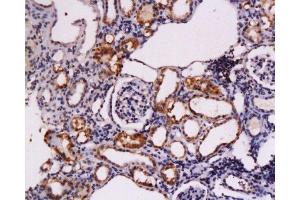 Immunohistochemistry (Paraffin-embedded Sections) (IHC (p)) image for anti-Mast/stem Cell Growth Factor Receptor (KIT) (AA 901-976) antibody (ABIN671721)