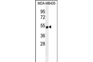 ZNF286B Antibody (N-term) (ABIN655669 and ABIN2845137) western blot analysis in MDA-M cell line lysates (35 μg/lane). (ZNF286B 抗体  (N-Term))