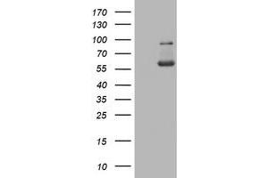 Western Blotting (WB) image for anti-PKM1 antibody (ABIN2729046) (PKM1 抗体)