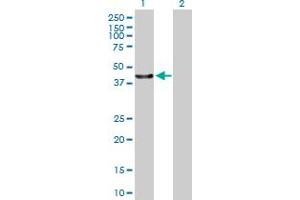 Western Blot analysis of C13orf31 expression in transfected 293T cell line by C13orf31 MaxPab polyclonal antibody. (LACC1 抗体  (AA 1-430))