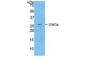 Detection of Recombinant Ceruloplasmin, Rat using Polyclonal Antibody to Ceruloplasmin (CP) (Ceruloplasmin 抗体  (AA 872-1059))