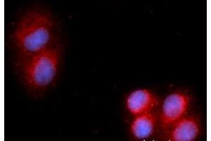Immunofluorescence (IF) image for anti-Acid Phosphatase, Prostate (ACPP) (AA 33-386) antibody (APC) (ABIN5564801)