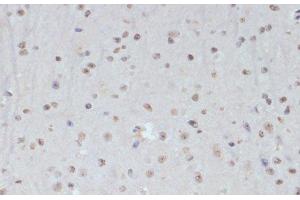 Immunohistochemistry (Paraffin-embedded Sections) (IHC (p)) image for anti-Cyclin-Dependent Kinase 1 (CDK1) (pTyr15) antibody (ABIN7265020)