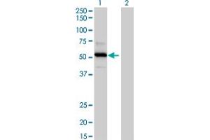 Western Blot analysis of TRAF4 expression in transfected 293T cell line by TRAF4 MaxPab polyclonal antibody. (TRAF4 抗体  (AA 1-470))
