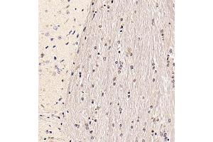 Immunohistochemistry of paraffin embedded mouse brain using RANBP6 (ABIN7075361) at dilution of 1:700 (300x lens) (RANBP6 抗体)