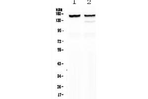 Western blot analysis of MYBPC3 using anti-MYBPC3 antibody . (MYBPC3 抗体  (AA 1070-1123))