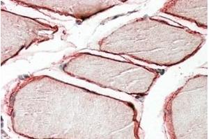 Image no. 1 for anti-Caveolin 3 (CAV3) (N-Term) antibody (ABIN375161) (Caveolin 3 抗体  (N-Term))