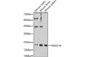 Western blot analysis of extracts of various cell lines, using TM4SF19 antibody (ABIN7270936) at 1:1000 dilution. (TM4SF19 抗体  (AA 50-150))