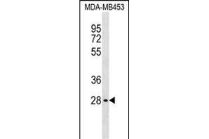 GBL Antibody (C-term) (ABIN1537039 and ABIN2838246) western blot analysis in MDA-M cell line lysates (35 μg/lane). (GBL 抗体  (C-Term))