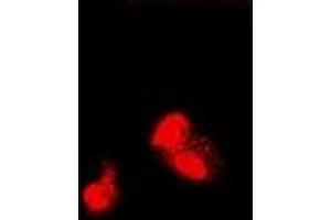 Immunofluorescent analysis of SIAH1 staining in U2OS cells. (SIAH1 抗体)