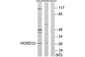 Western blot analysis of extracts from COLO205/HucEc cells, treated with serum 20% 15', using HOXD12 Antibody. (HOXD12 抗体  (AA 191-240))