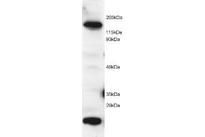 ABIN184584 (2 µg/mL) staining of Hela lysate (RIPA buffer, 1. (MTR 抗体  (C-Term))