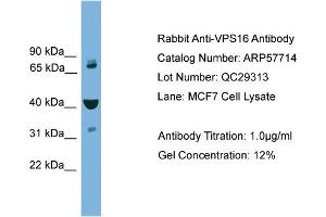 WB Suggested Anti-VPS16  Antibody Titration: 0. (VPS16 抗体  (Middle Region))
