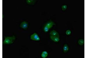 Immunofluorescent analysis of MCF-7 cells using ABIN7145812 at dilution of 1:100 and Alexa Fluor 488-congugated AffiniPure Goat Anti-Rabbit IgG(H+L) (BRD4 抗体  (AA 150-200))