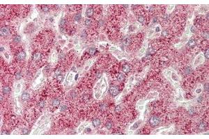 Detection of DDIT3 in Human Liver Tissue using Polyclonal Antibody to DNA Damage Inducible Transcript 3 (DDIT3)