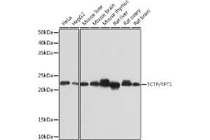 Western blot analysis of extracts of various cell lines, using TCTP/TPT1 Rabbit mAb (ABIN7271101) at 1:1000 dilution. (TPT1 抗体)