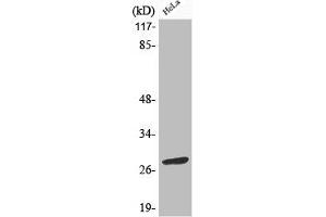 Western Blotting (WB) image for anti-B-Cell CLL/lymphoma 2 (BCL2) (pSer70) antibody (ABIN7180527)