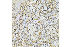 Immunohistochemistry of paraffin-embedded human kidney using BSG Antibody (ABIN5970747) at dilution of 1/200 (40x lens). (CD147 抗体)