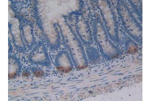DAB staining on IHC-P; Samples: Rat Intestine Tissue (Osteopontin 抗体  (AA 17-317))