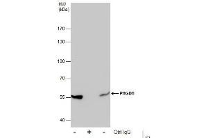 IP Image Immunoprecipitation of PHGDH protein from 293T whole cell extracts using 5 μg of PHGDH antibody [N1N2], N-term, Western blot analysis was performed using PHGDH antibody [N1N2], N-term, EasyBlot anti-Rabbit IgG  was used as a secondary reagent.