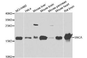 Western blot analysis of extracts of various cell lines, using SNCA antibody. (SNCA 抗体  (AA 61-140))