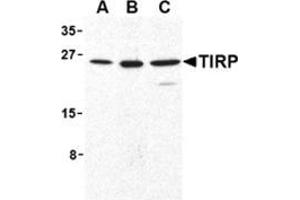 Western blot analysis of TIRP in human (A), mouse (B), and rat (C) kidney cell lysates with this product at 1 μg/ml.