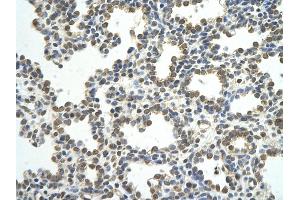 Immunohistochemistry (IHC) image for anti-Cleavage Stimulation Factor, 3' Pre-RNA, Subunit 2, 64kDa (CSTF2) (N-Term) antibody (ABIN2778764)