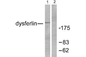 Western Blotting (WB) image for anti-Dysferlin (DYSF) (C-Term) antibody (ABIN1848514) (Dysferlin 抗体  (C-Term))