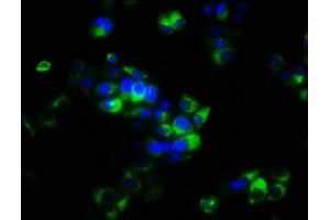 Immunofluorescence staining of PC-3 cells with ABIN7166152 at 1:266, counter-stained with DAPI. (SPRY4 抗体  (AA 1-299))
