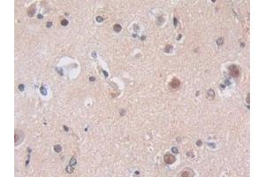 Detection of NUP50 in Human Cerebrum Tissue using Polyclonal Antibody to Nucleoporin 50 kDa (NUP50) (NUP50 抗体  (AA 37-269))
