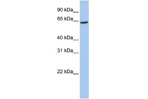 WB Suggested Anti-SLC13A2 Antibody Titration:  0. (SLC13A2 抗体  (Middle Region))