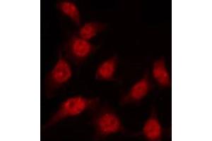 ABIN6267454 staining K562 by IF/ICC. (MKP-1/2 抗体  (pSer296, pSer318))