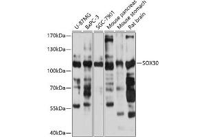Western blot analysis of extracts of various cell lines, using SOX30 antibody (ABIN6131031, ABIN6148300, ABIN6148302 and ABIN6215454) at 1:1000 dilution. (SOX30 抗体  (AA 1-150))