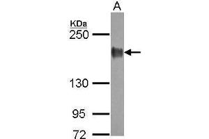 WB Image Sample (30 ug of whole cell lysate) A: A431 5% SDS PAGE antibody diluted at 1:10000