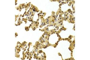 Immunohistochemistry of paraffin-embedded rat lung using CDK4 Antibody. (CDK4 抗体  (AA 1-303))