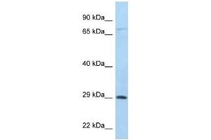 Western Blot showing F11R antibody used at a concentration of 1 ug/ml against 721_B Cell Lysate (F11R 抗体  (C-Term))