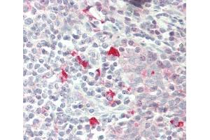 Immunohistochemistry (Paraffin-embedded Sections) (IHC (p)) image for anti-Zinc Finger (CCCH Type), RNA-Binding Motif and serine/arginine Rich 2 (ZRSR2) (AA 453-482), (C-Term) antibody (ABIN1882041)