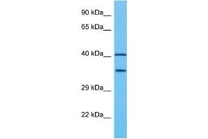 Host:  Rabbit  Target Name:  PAX2  Sample Tissue:  Human Ovary Tumor  Antibody Dilution:  1ug/ml (PAX2A 抗体  (Middle Region))