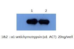 Western Blotting (WB) image for anti-serpin Peptidase Inhibitor, Clade A (Alpha-1 Antiproteinase, Antitrypsin), Member 3 (SERPINA3) antibody (ABIN1105309) (SERPINA3 抗体)