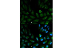 Immunofluorescence analysis of HepG2 cells using CAPZA2 antibody. (CAPZA2 抗体)