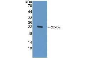 Detection of Recombinant SOD1, Equine using Polyclonal Antibody to Superoxide Dismutase 1 (SOD1) (SOD1 抗体  (AA 2-154))