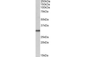 ABIN185206 (1 µg/mL) staining of Human Brain (Cerebellum) lysate (35 µg protein in RIPA buffer). (VDAC2 抗体  (C-Term))